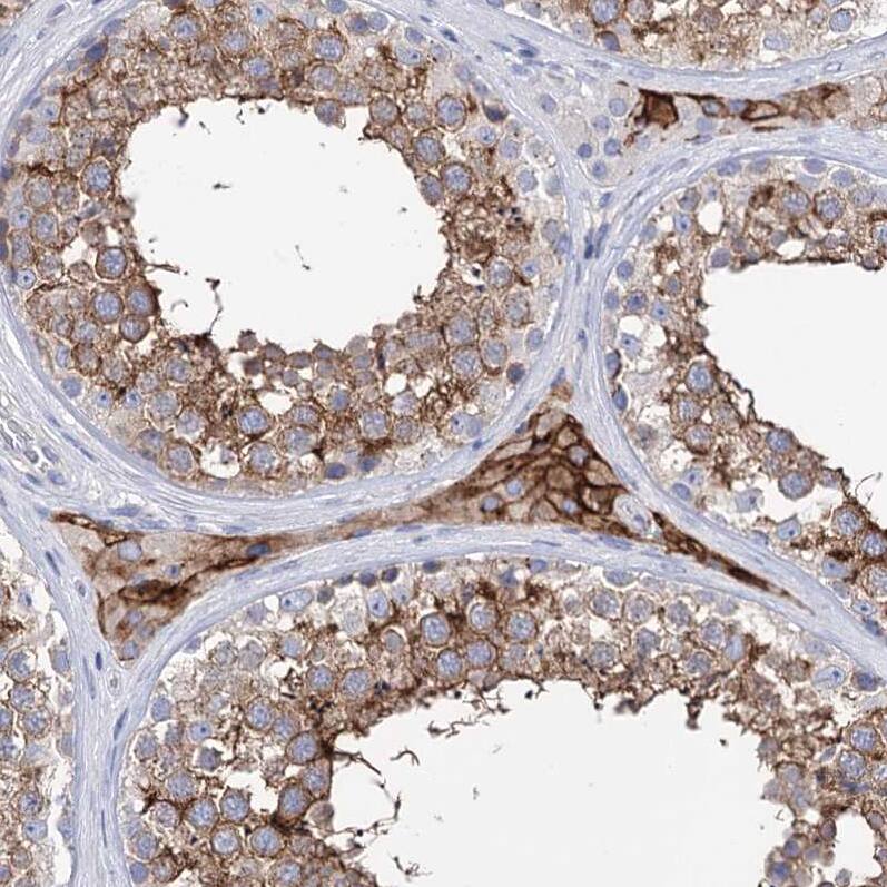 BBS4 Antibody - BSA Free Immunohistochemistry-Paraffin: BBS4 Antibody - BSA Free [NBP1-86248]