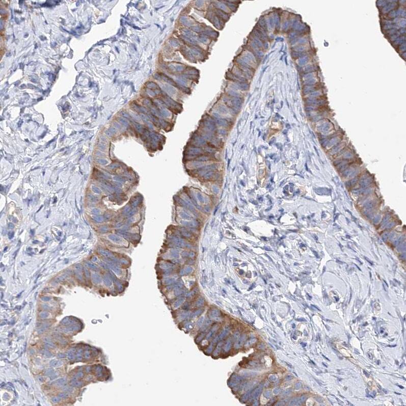 BBS4 Antibody - BSA Free Immunohistochemistry-Paraffin: BBS4 Antibody - BSA Free [NBP1-86248]