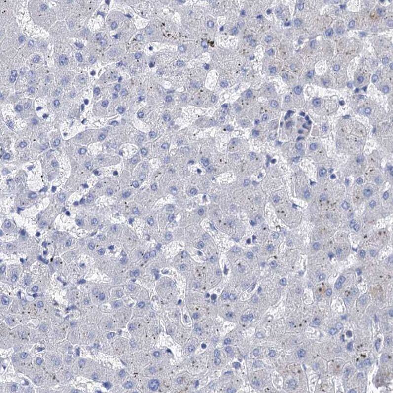 BBS4 Antibody - BSA Free Immunohistochemistry-Paraffin: BBS4 Antibody - BSA Free [NBP1-86248]