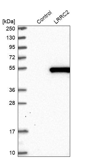 LRRC2 Antibody - BSA Free Western Blot: LRRC2 Antibody - BSA Free [NBP1-86250]