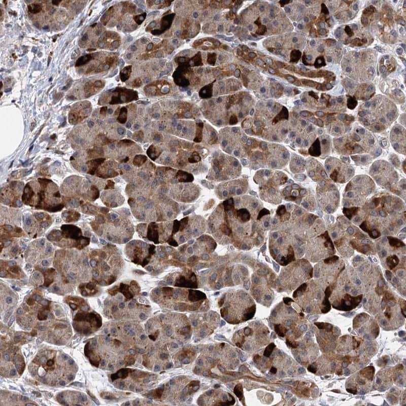 UBR1 Antibody - BSA Free Immunohistochemistry-Paraffin: UBR1 Antibody [NBP1-86253]
