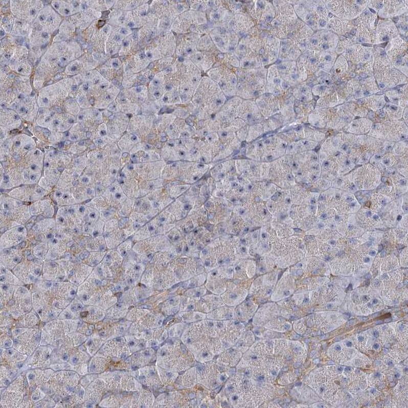 SEC24B Antibody - BSA Free Immunohistochemistry-Paraffin: SEC24B Antibody - BSA Free [NBP1-86263]