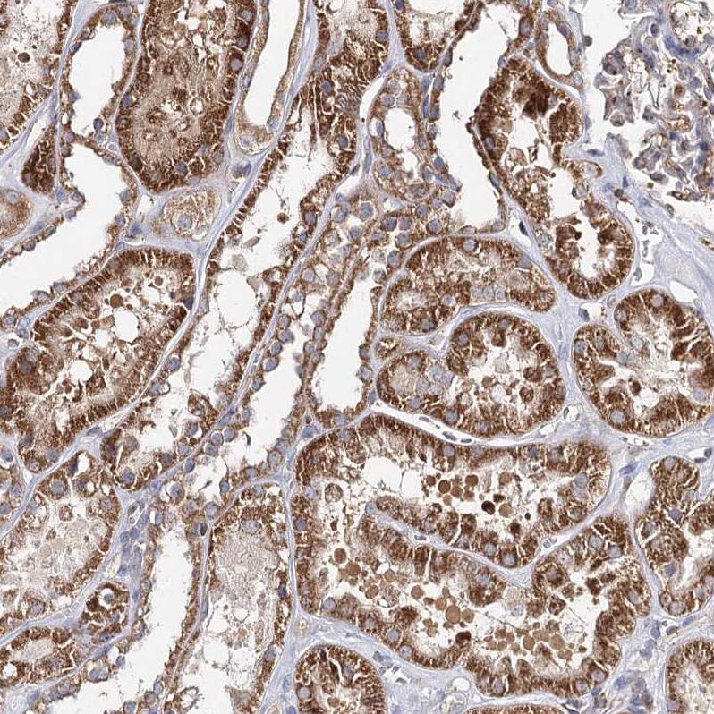 SEC24B Antibody - BSA Free Immunohistochemistry-Paraffin: SEC24B Antibody - BSA Free [NBP1-86263]