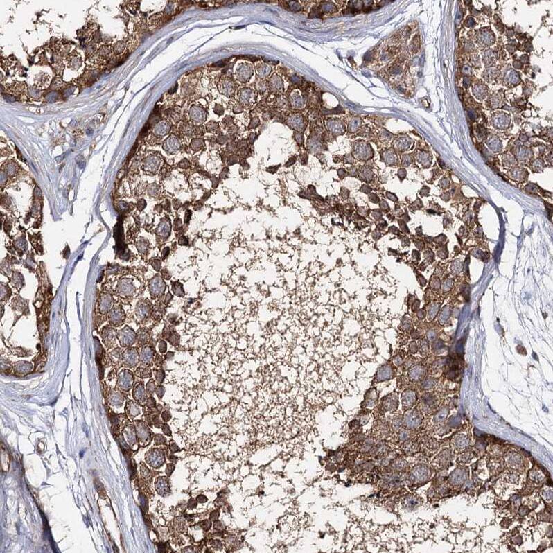SEC24B Antibody - BSA Free Immunohistochemistry-Paraffin: SEC24B Antibody - BSA Free [NBP1-86263]
