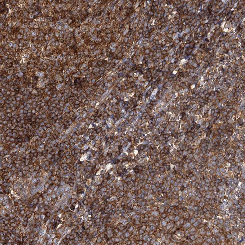 SEC24B Antibody - BSA Free Immunohistochemistry-Paraffin: SEC24B Antibody - BSA Free [NBP1-86263]
