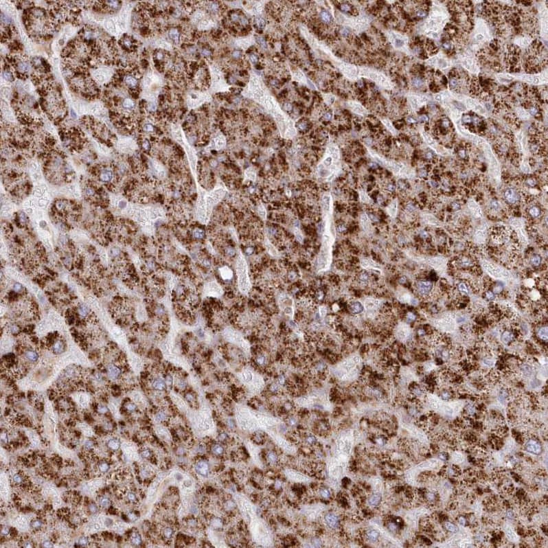 Arylsulfatase B/ARSB Antibody - BSA Free Immunohistochemistry-Paraffin: Arylsulfatase B/ARSB Antibody - BSA Free [NBP1-86270]