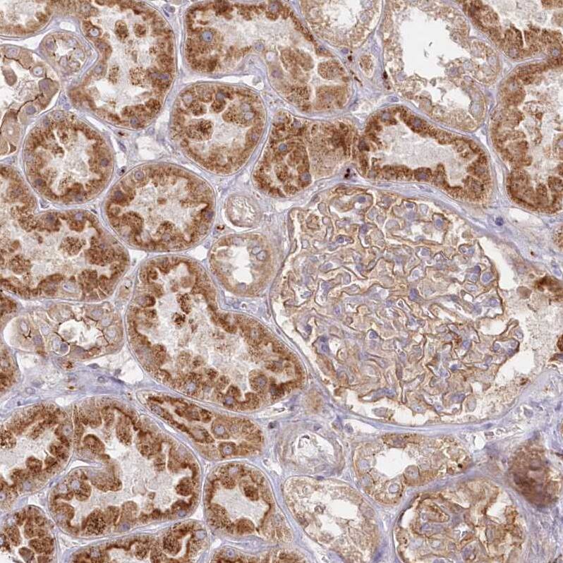 Arylsulfatase B/ARSB Antibody - BSA Free Immunohistochemistry-Paraffin: Arylsulfatase B/ARSB Antibody - BSA Free [NBP1-86270]