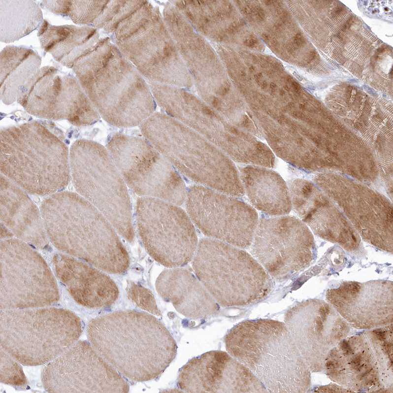 Arylsulfatase B/ARSB Antibody - BSA Free Immunohistochemistry-Paraffin: Arylsulfatase B/ARSB Antibody - BSA Free [NBP1-86270]