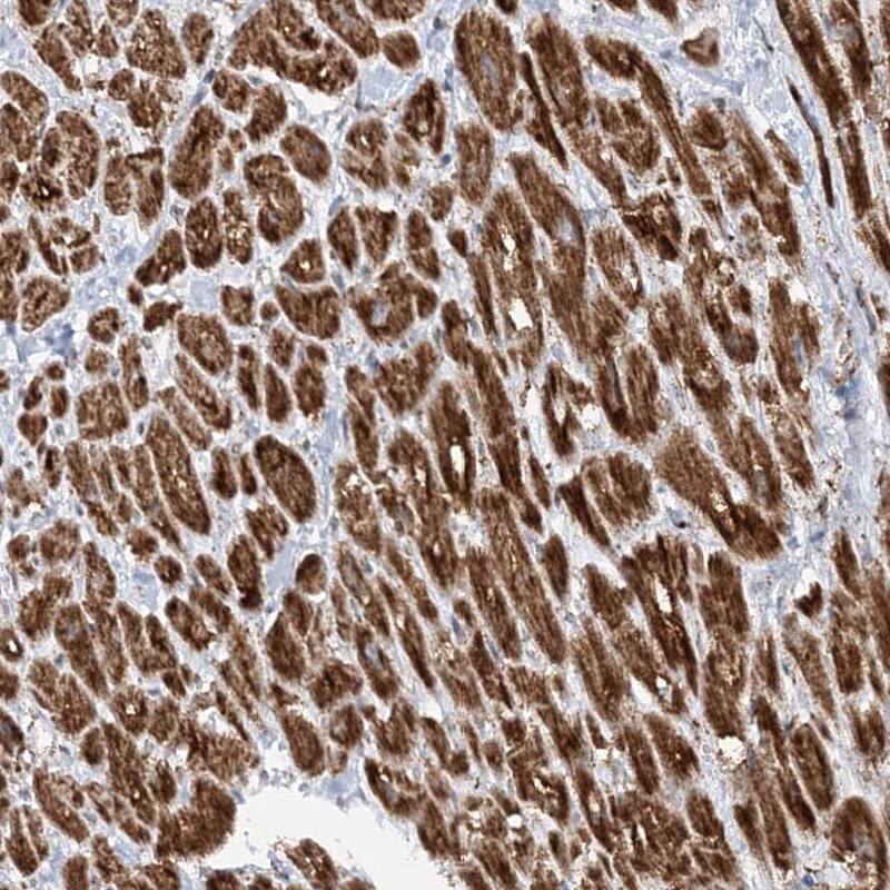 CRY2 Antibody - BSA Free Immunohistochemistry-Paraffin: CRY2 Antibody [NBP1-86273]