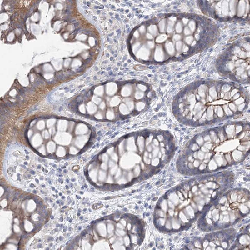 PIGC Antibody - BSA Free Immunohistochemistry-Paraffin: PIGC Antibody [NBP1-86283]