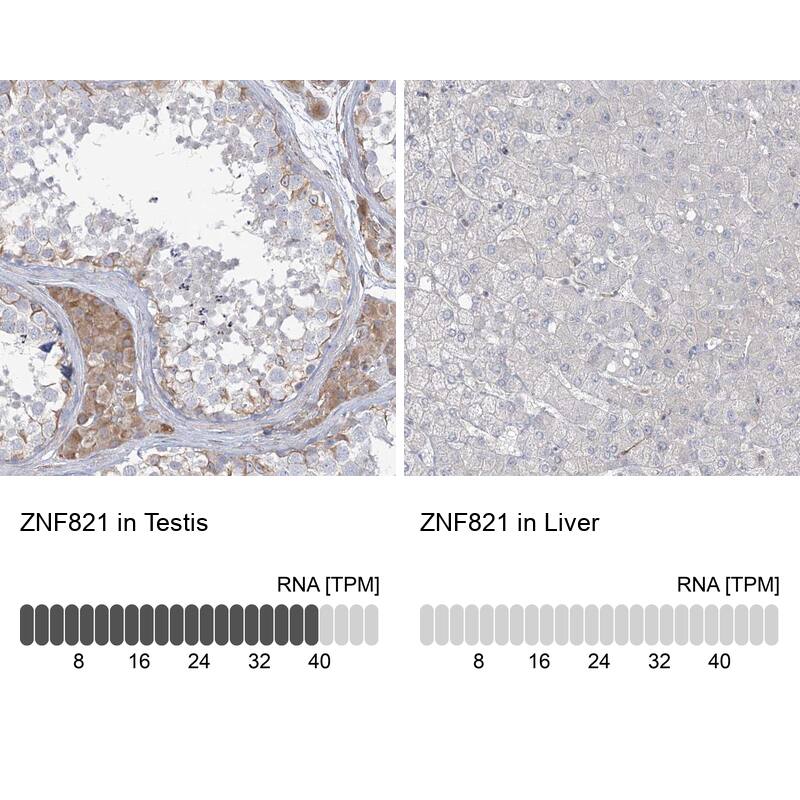 ZNF821 Antibody - BSA Free Immunohistochemistry-Paraffin: ZNF821 Antibody [NBP1-86290]