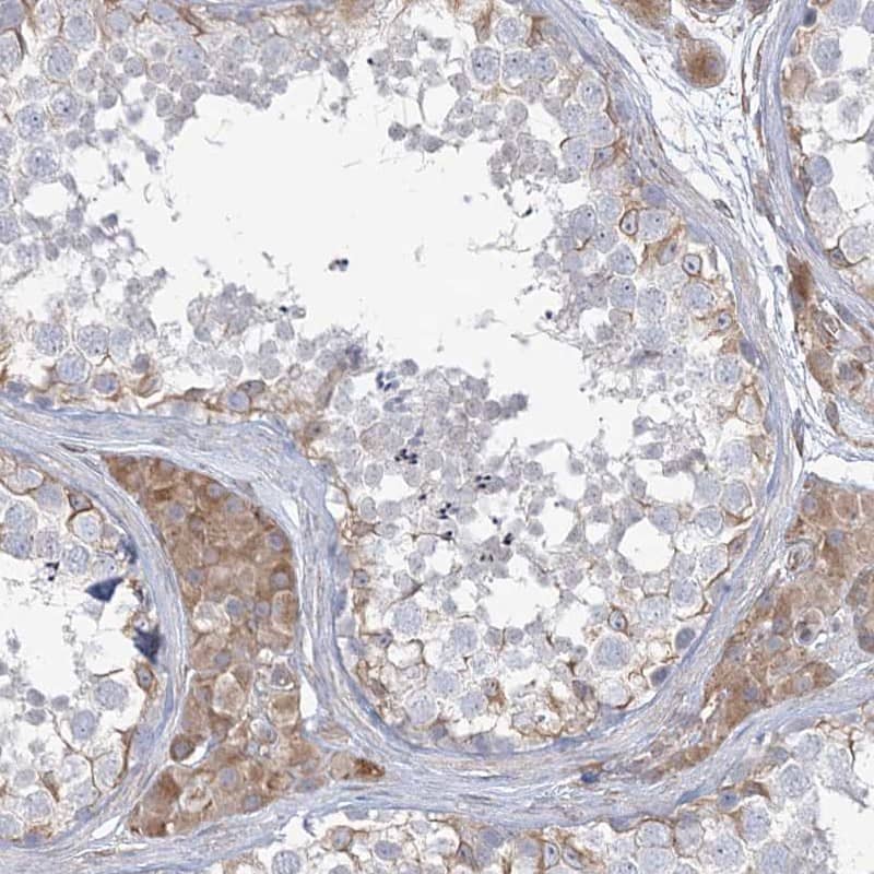 ZNF821 Antibody - BSA Free Immunohistochemistry-Paraffin: ZNF821 Antibody [NBP1-86290]