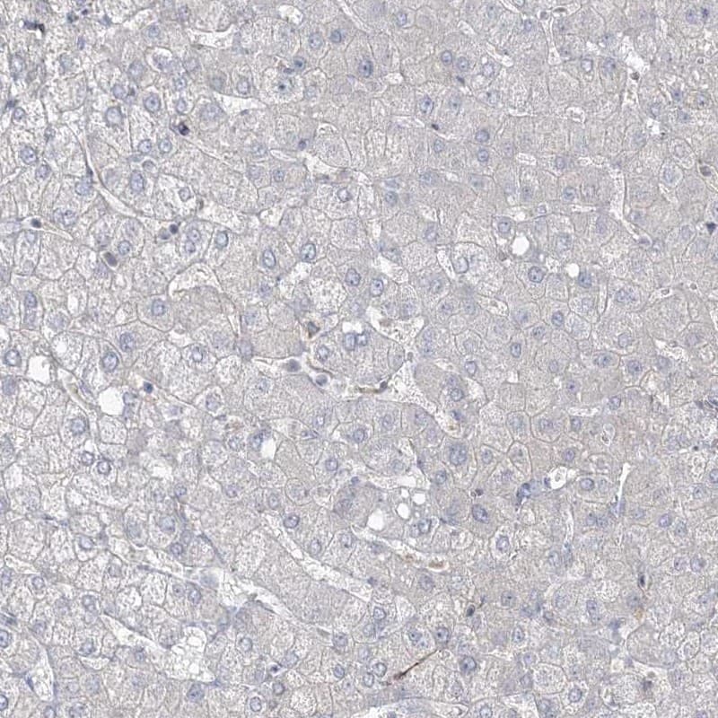 ZNF821 Antibody - BSA Free Immunohistochemistry-Paraffin: ZNF821 Antibody [NBP1-86290]