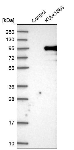 KIAA1586 Antibody - BSA Free Western Blot: KIAA1586 Antibody - BSA Free [NBP1-86291]