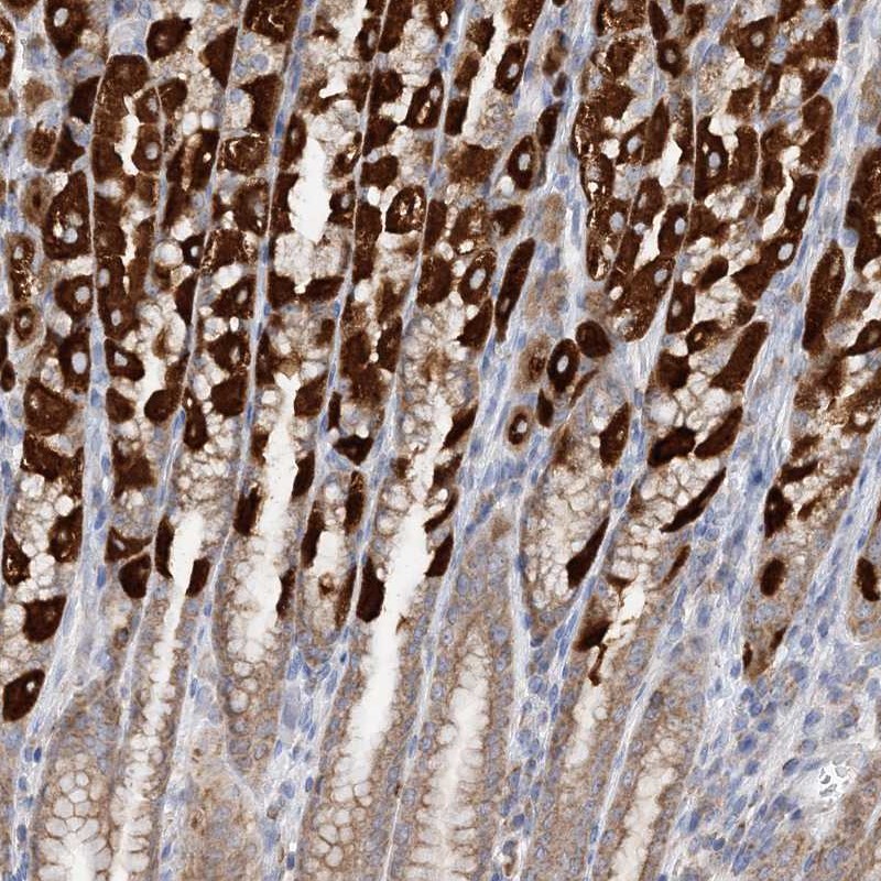 TTC32 Antibody - BSA Free Immunohistochemistry-Paraffin: TTC32 Antibody - BSA Free [NBP1-86295]