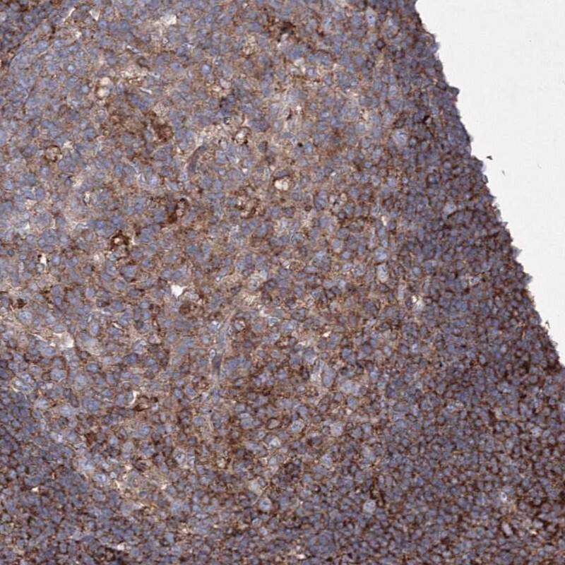 GPR82 Antibody - BSA Free Immunohistochemistry-Paraffin: GPR82 Antibody - BSA Free [NBP1-86298]