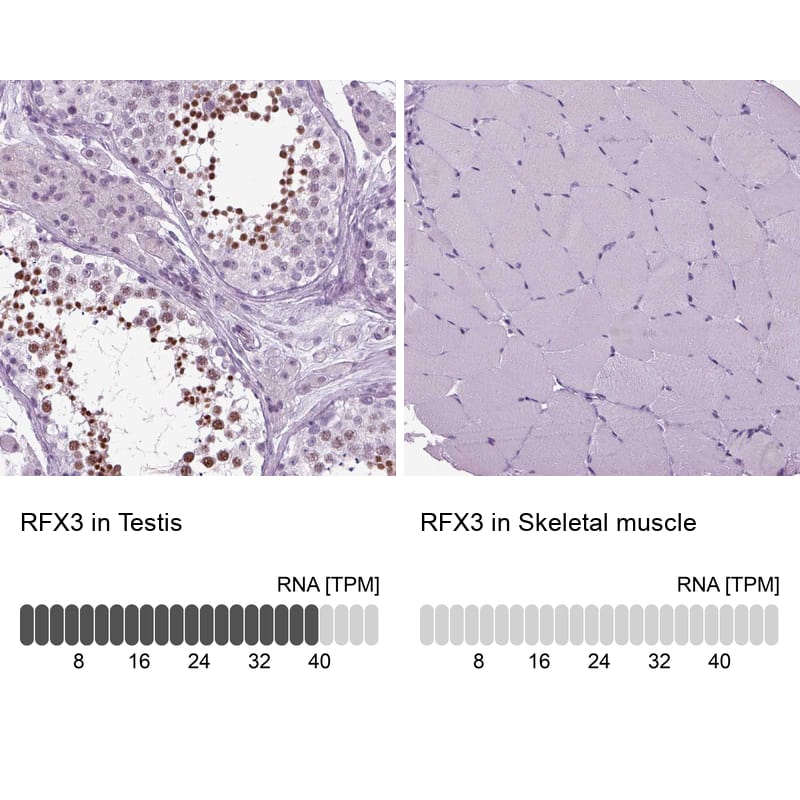 RFX3 Antibody - BSA Free Immunohistochemistry-Paraffin: RFX3 Antibody - BSA Free [NBP1-86301]