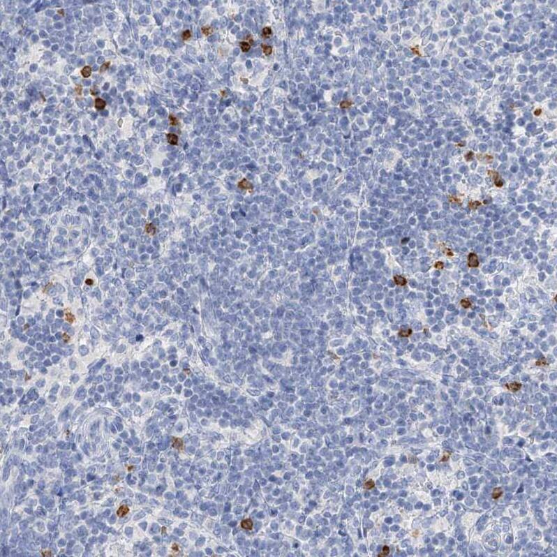PAFAH1B3 Antibody - BSA Free Immunohistochemistry-Paraffin: PAFAH1B3 Antibody - BSA Free [NBP1-86305]