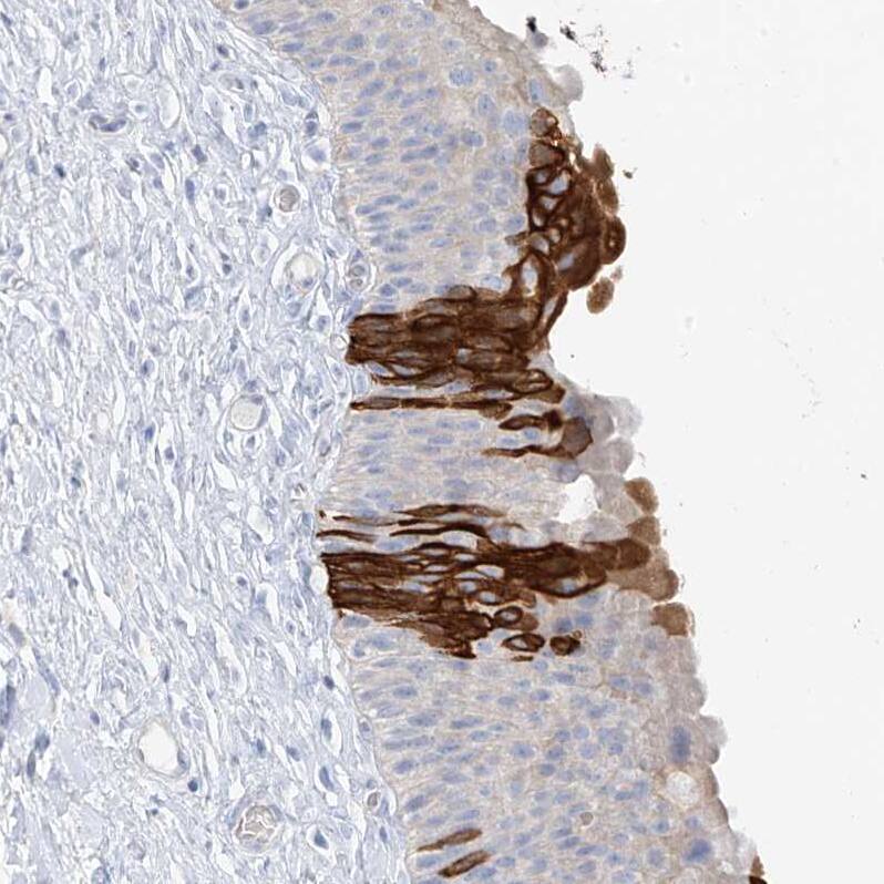 PAFAH1B3 Antibody - BSA Free Immunohistochemistry-Paraffin: PAFAH1B3 Antibody - BSA Free [NBP1-86305]