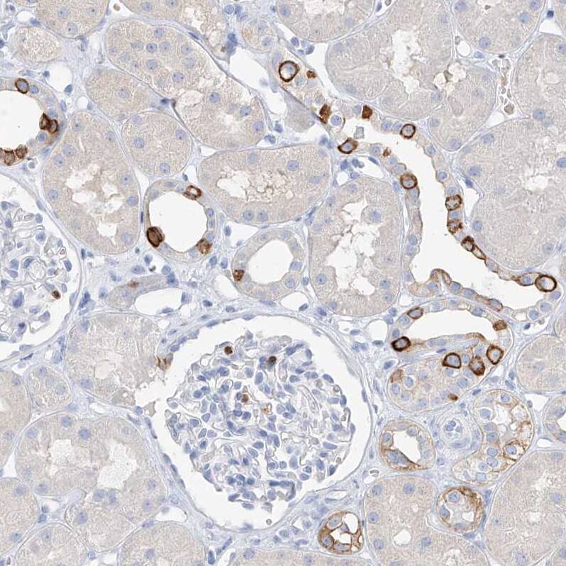 PAFAH1B3 Antibody - BSA Free Immunohistochemistry-Paraffin: PAFAH1B3 Antibody - BSA Free [NBP1-86305]