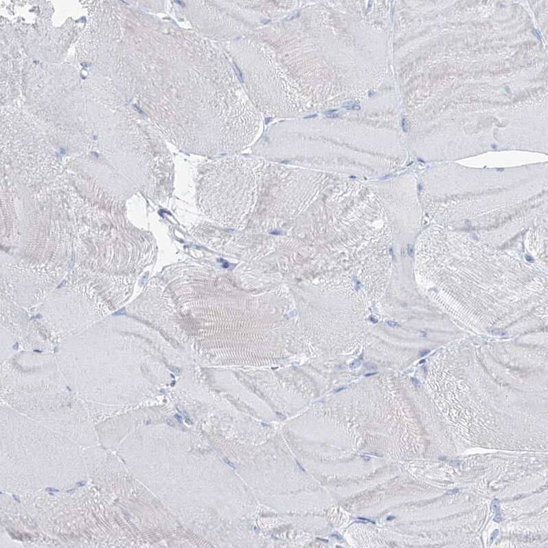 PAFAH1B3 Antibody - BSA Free Immunohistochemistry-Paraffin: PAFAH1B3 Antibody - BSA Free [NBP1-86305]