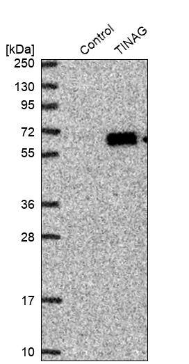 TIN-Ag Antibody - BSA Free Western Blot: TIN-Ag Antibody - BSA Free [NBP1-86307]