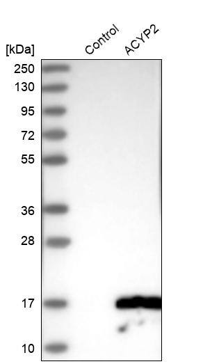 ACYP2 Antibody - BSA Free Western Blot: ACYP2 Antibody - BSA Free [NBP1-86308]
