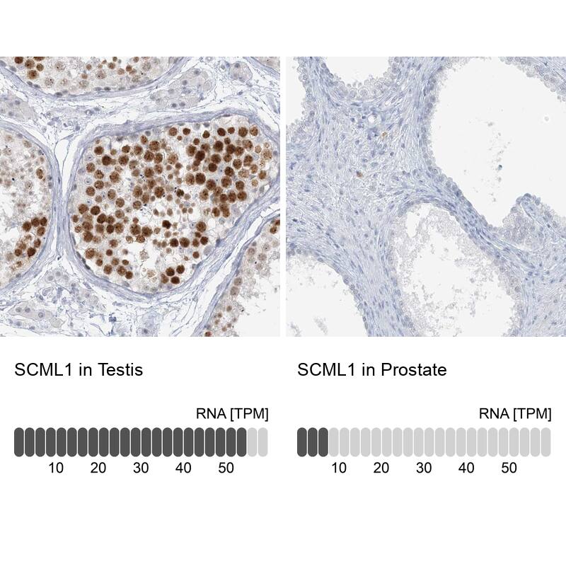 SCML1 Antibody - BSA Free Immunohistochemistry-Paraffin: SCML1 Antibody [NBP1-86309]