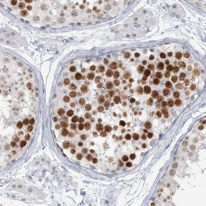 SCML1 Antibody - BSA Free Immunohistochemistry-Paraffin: SCML1 Antibody [NBP1-86309]