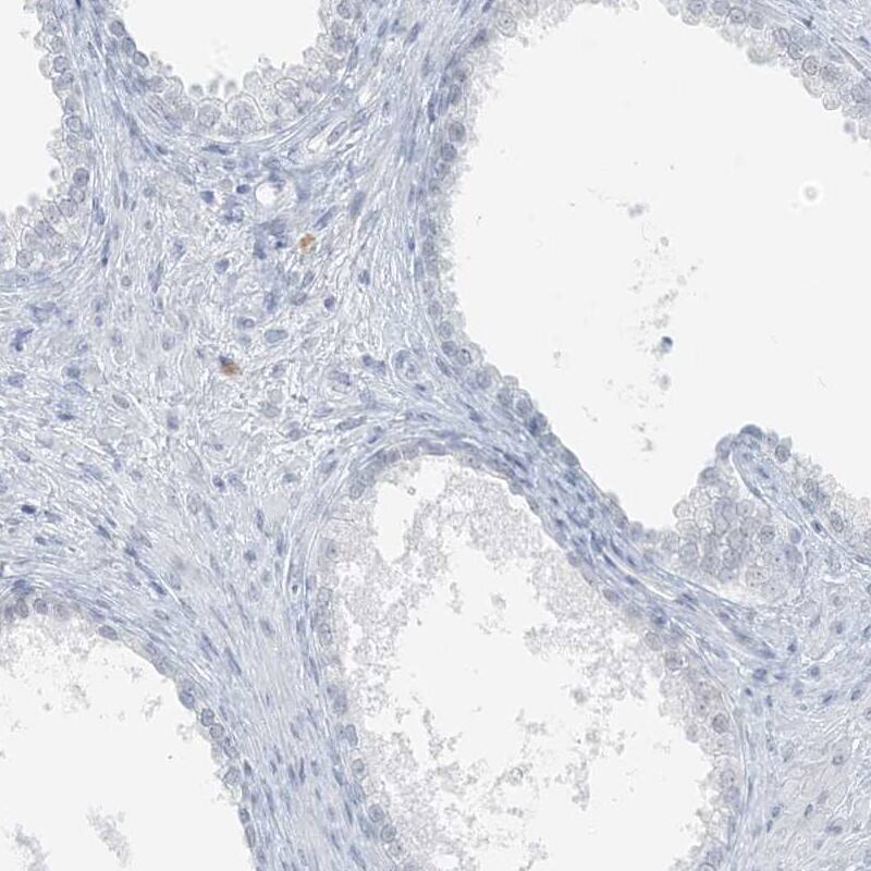 SCML1 Antibody - BSA Free Immunohistochemistry-Paraffin: SCML1 Antibody [NBP1-86309]