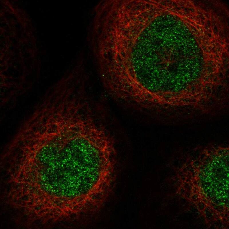 SLC25A43 Antibody - BSA Free Immunocytochemistry/ Immunofluorescence: SLC25A43 Antibody [NBP1-86310]