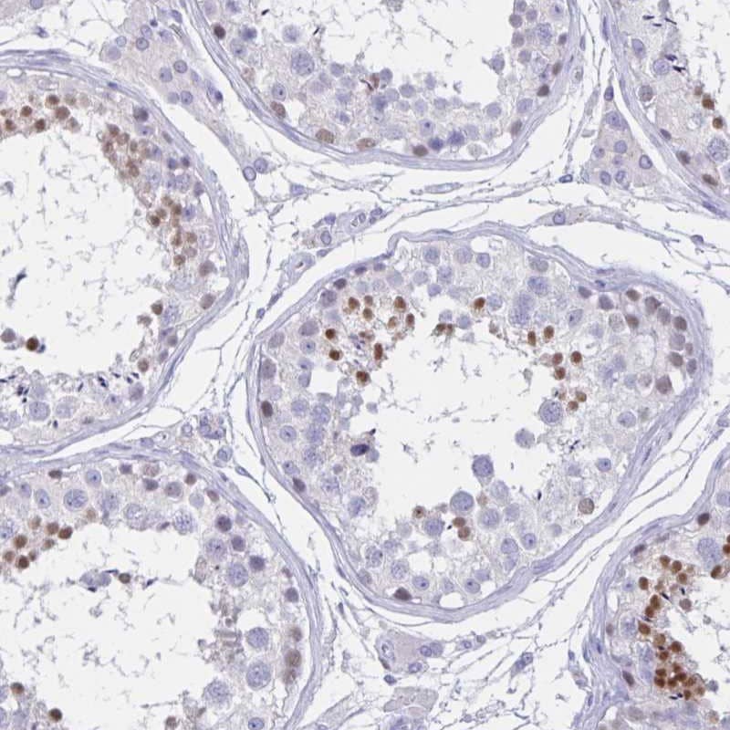 TGIF2LX Antibody - BSA Free Immunohistochemistry-Paraffin: TGIF2LX Antibody - BSA Free [NBP1-86320]
