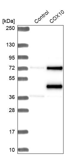 COX10 Antibody - BSA Free Western Blot: COX10 Antibody - BSA Free [NBP1-86322]