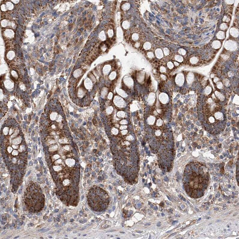SDHAF4 Antibody - BSA Free Immunohistochemistry-Paraffin: SDHAF4 Antibody [NBP1-86324]