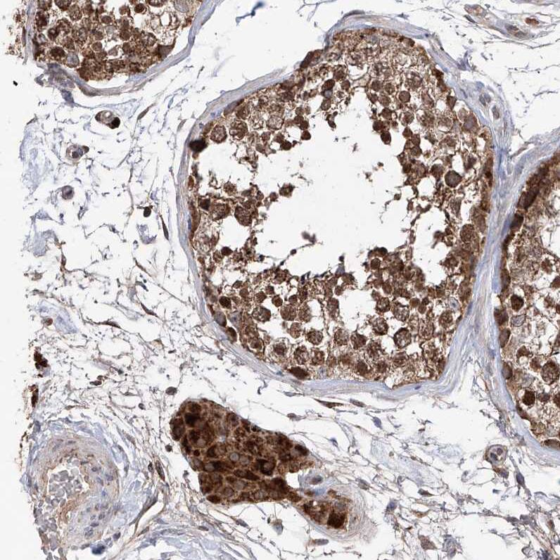 SDHAF4 Antibody - BSA Free Immunohistochemistry-Paraffin: SDHAF4 Antibody [NBP1-86324]