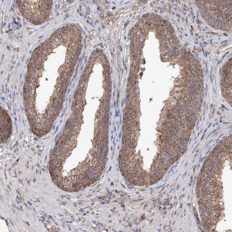 SDHAF4 Antibody - BSA Free Immunohistochemistry-Paraffin: SDHAF4 Antibody [NBP1-86324]