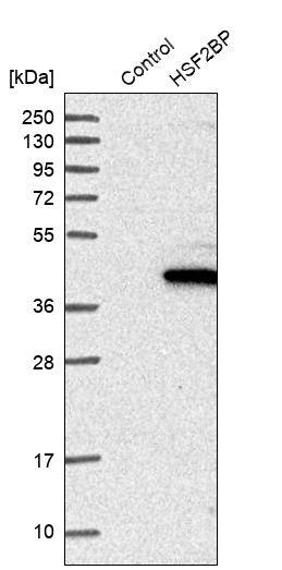 HSF2BP Antibody - BSA Free Western Blot: HSF2BP Antibody - BSA Free [NBP1-86325]