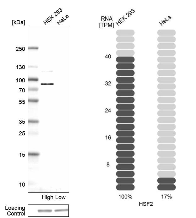 HSF2 Antibody - BSA Free Western Blot: HSF2 Antibody - BSA Free [NBP1-86330]