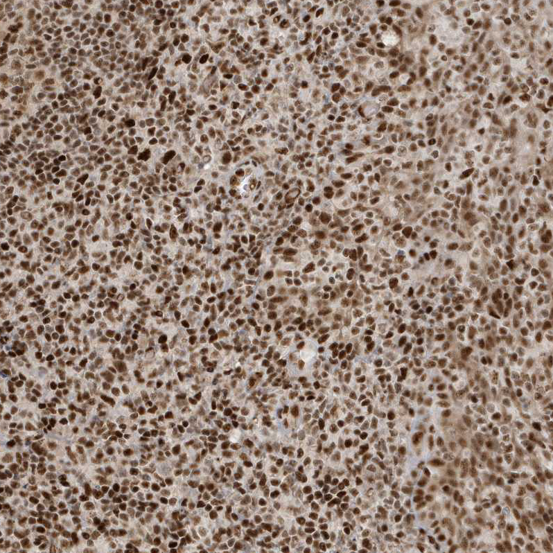 CKS2 Antibody - BSA Free Immunohistochemistry-Paraffin: CKS2 Antibody - BSA Free [NBP1-86336]