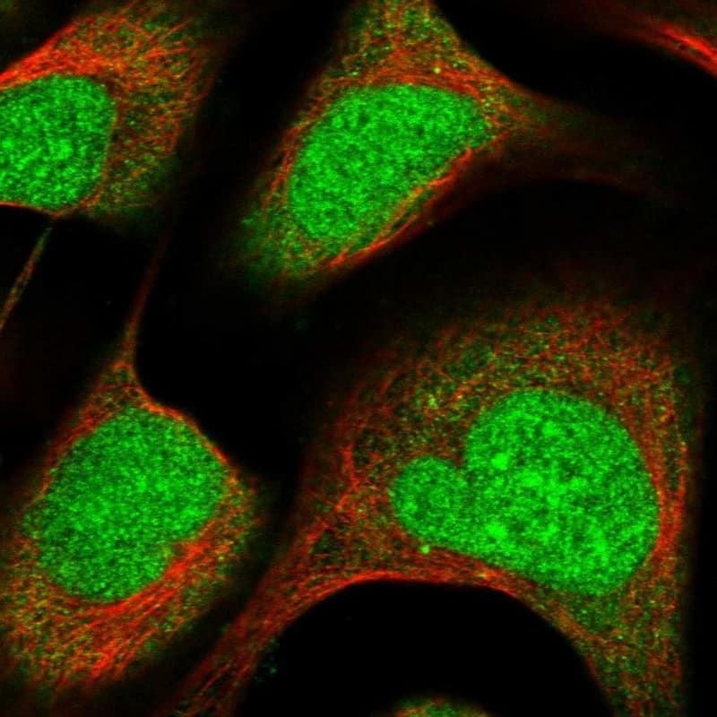 ZNF195 Antibody - BSA Free Immunocytochemistry/ Immunofluorescence: ZNF195 Antibody [NBP1-86338]