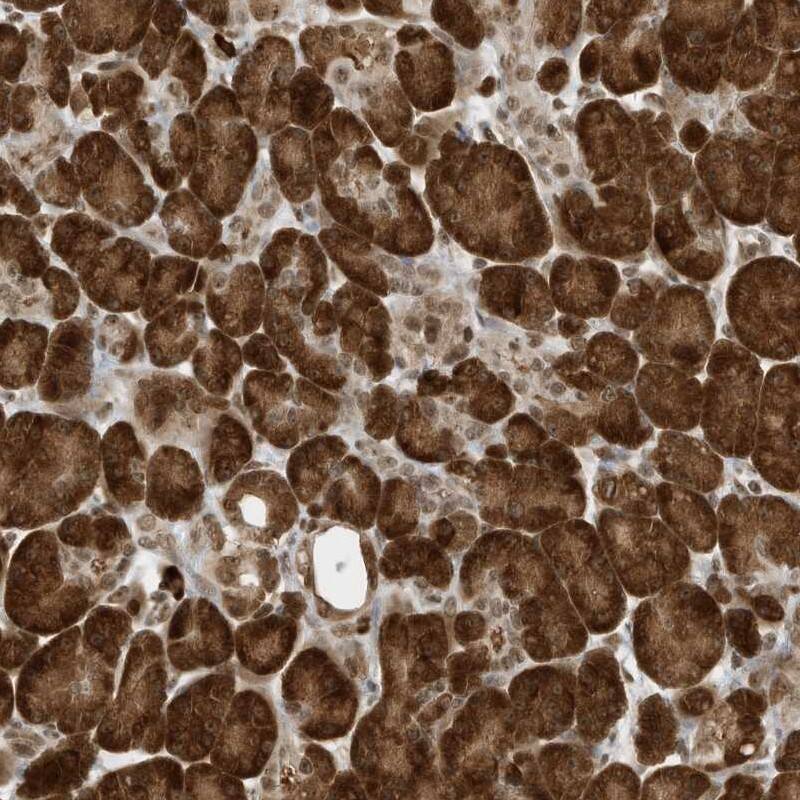 ZNF195 Antibody - BSA Free Immunohistochemistry-Paraffin: ZNF195 Antibody - BSA Free [NBP1-86338]