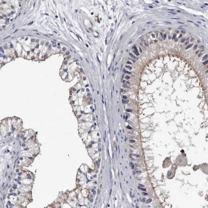 Prostasin/Prss8 Antibody - BSA Free Immunohistochemistry-Paraffin: Prostasin/Prss8 Antibody - BSA Free [NBP1-86340]