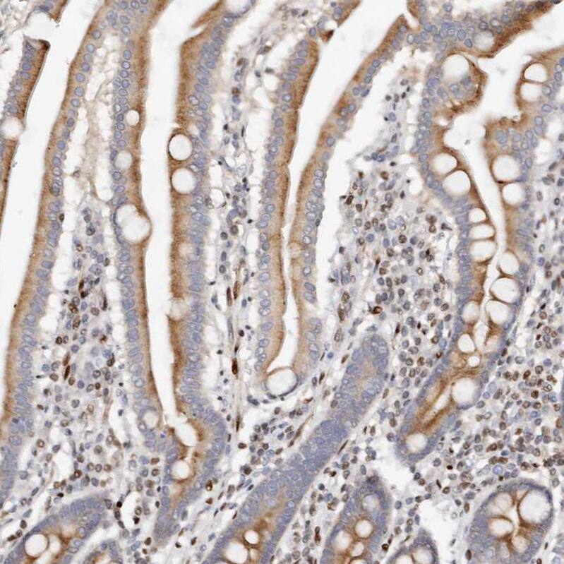 IQGAP3 Antibody - BSA Free Immunohistochemistry-Paraffin: IQGAP3 Antibody - BSA Free [NBP1-86342]