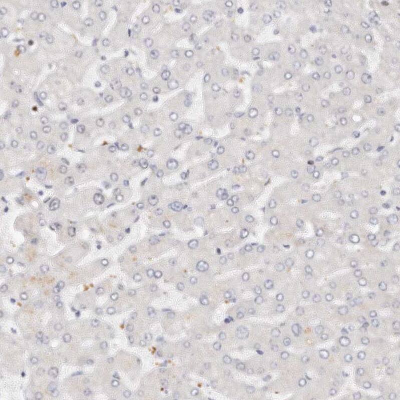 IQGAP3 Antibody - BSA Free Immunohistochemistry-Paraffin: IQGAP3 Antibody - BSA Free [NBP1-86342]