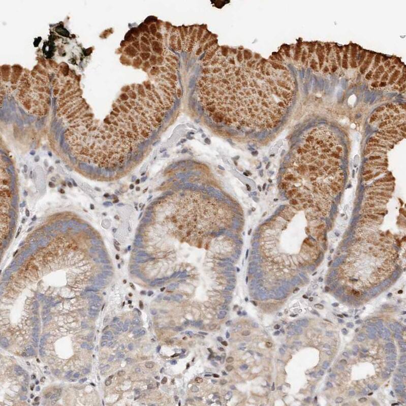 IQGAP3 Antibody - BSA Free Immunohistochemistry-Paraffin: IQGAP3 Antibody - BSA Free [NBP1-86342]