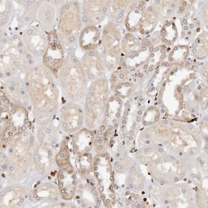 IQGAP3 Antibody - BSA Free Immunohistochemistry-Paraffin: IQGAP3 Antibody - BSA Free [NBP1-86342]