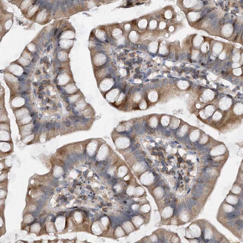 PGBD2 Antibody - BSA Free Immunohistochemistry-Paraffin: PGBD2 Antibody - BSA Free [NBP1-86349]
