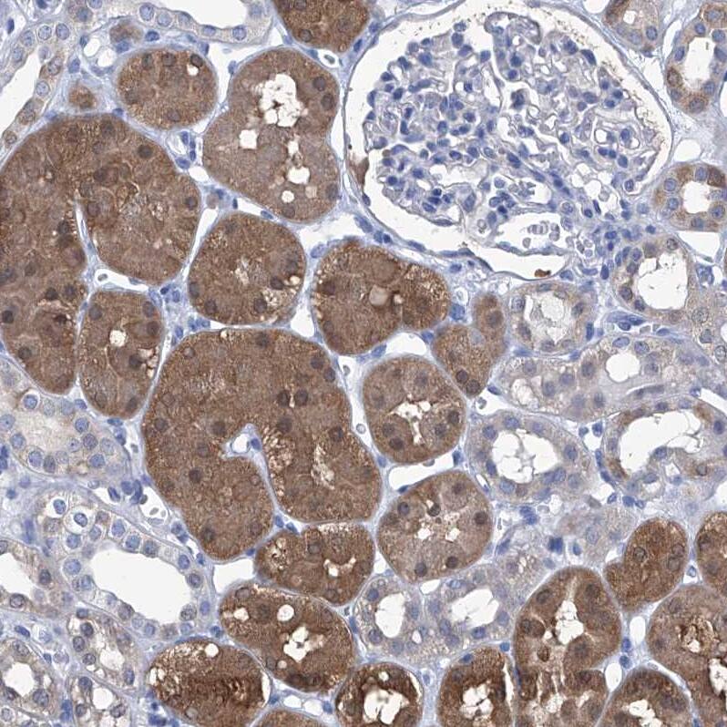IMPA2 Antibody - BSA Free Immunohistochemistry-Paraffin: IMPA2 Antibody - BSA Free [NBP1-86352]