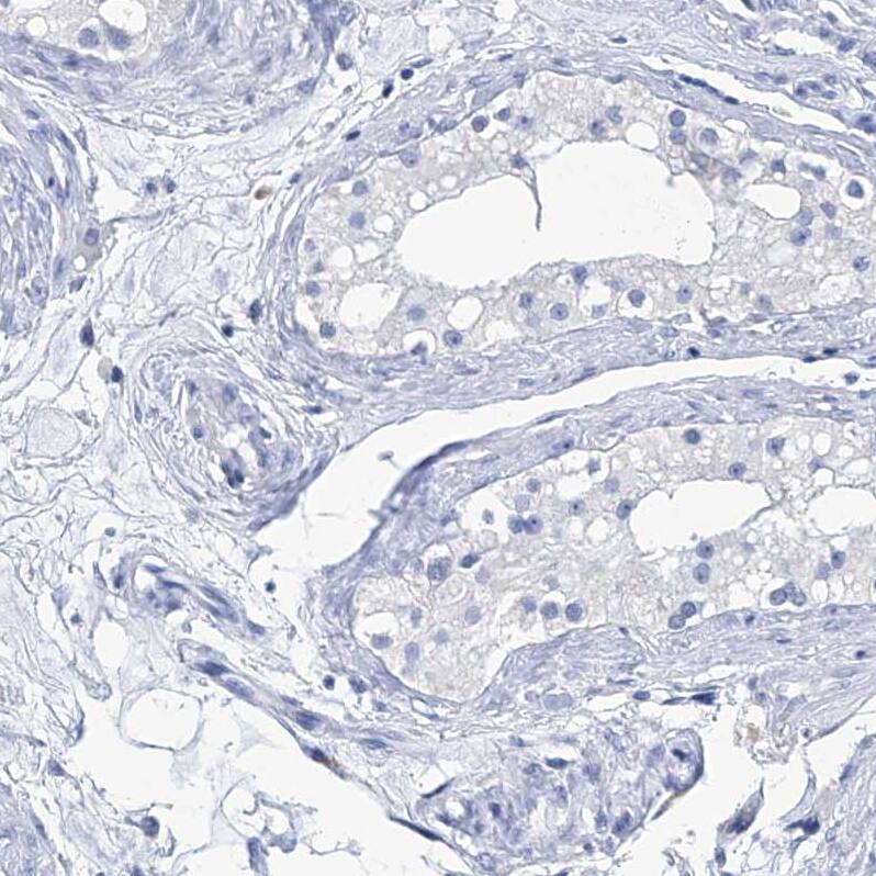IMPA2 Antibody - BSA Free Immunohistochemistry-Paraffin: IMPA2 Antibody - BSA Free [NBP1-86352]