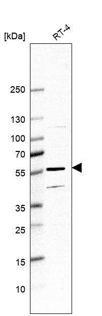 Hyaluronidase 4/HYAL4 Antibody - BSA Free Western Blot: Hyaluronidase 4/HYAL4 Antibody - BSA Free [NBP1-86355]